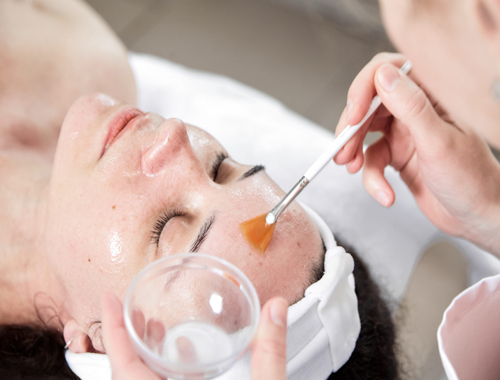 THINGS YOU SHOULD FOLLOW BEFORE AND AFTER CHEMICAL PEEL.